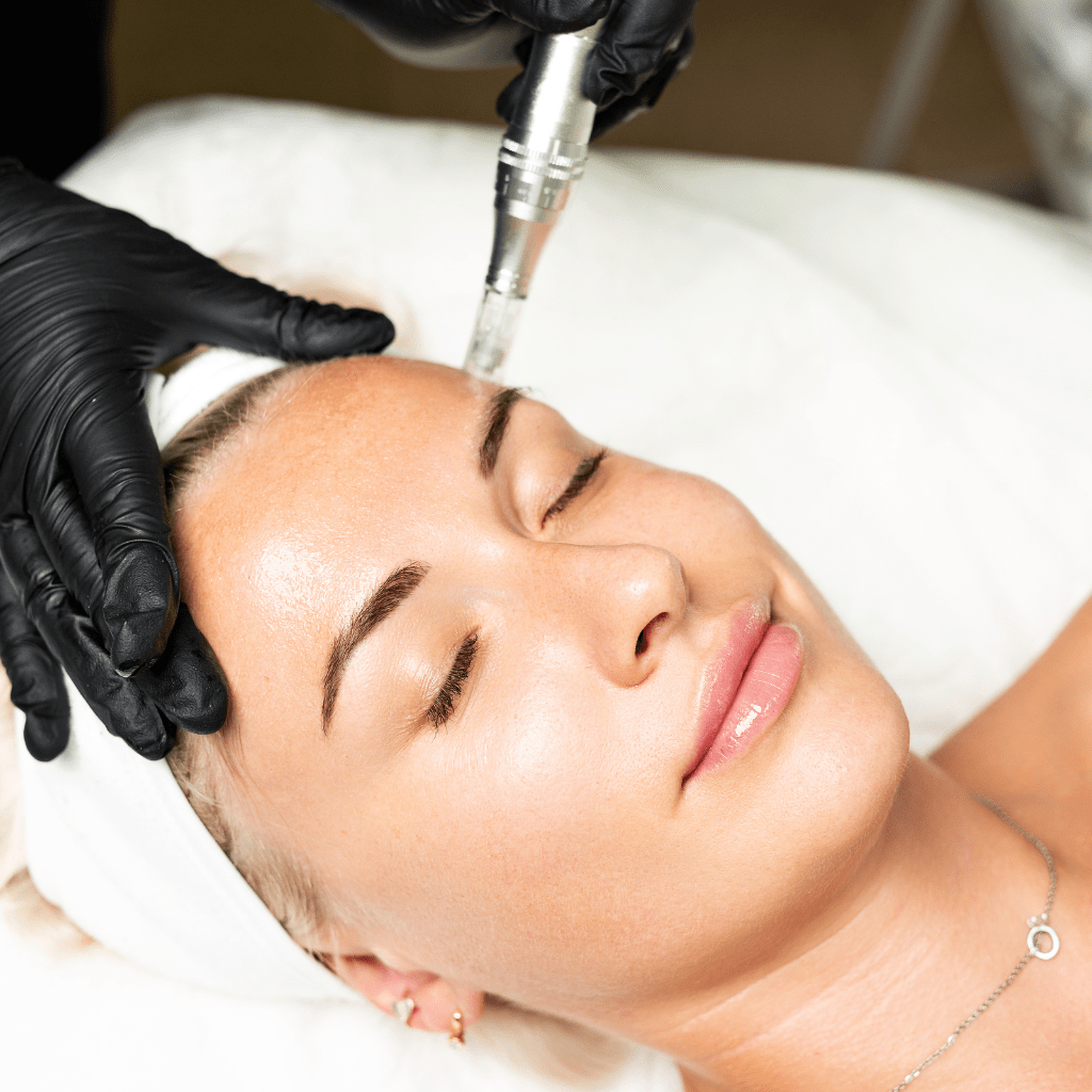 Skin Needling + Exosomes
