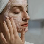 managing rosacea naturally