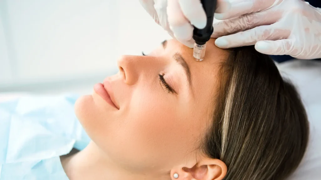 skin needling benefits
