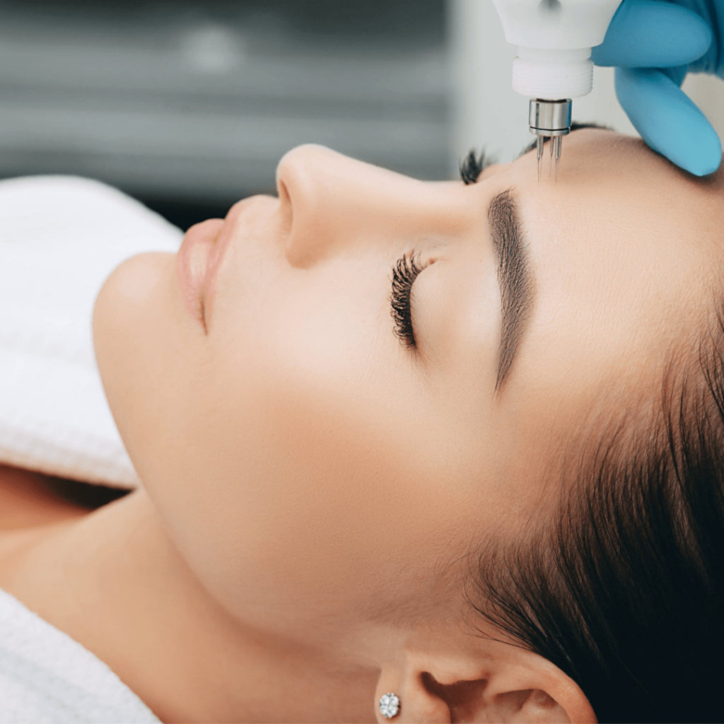 skin needling